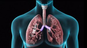 World Lung Cancer Day: Major revelation in KGMU study—over half of the patients suffer from anxiety; mental health highlighted.